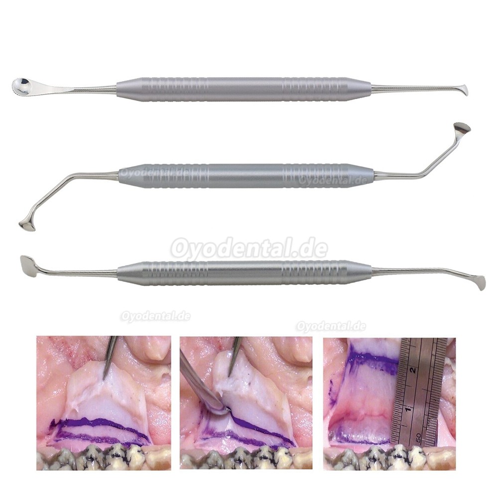 Dental WEN Tension Release Kit Periost gezähnter GBR Primärverschluss