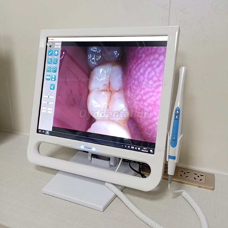 YF-1700P+ 17-Zoll Dental-Intraoralkamera Touch LCD-Bildschirm für Dentaleinheit mit Halterung